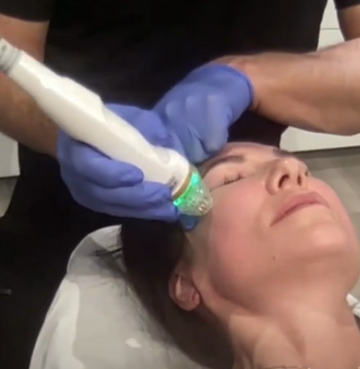 silkro rf microneedling training for medical aesthetics